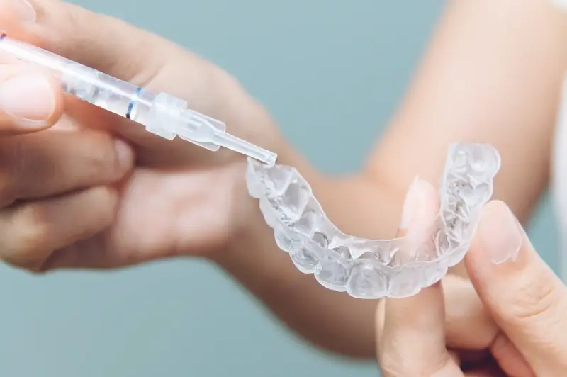 Jak długo trwa leczenie Invisalign?
