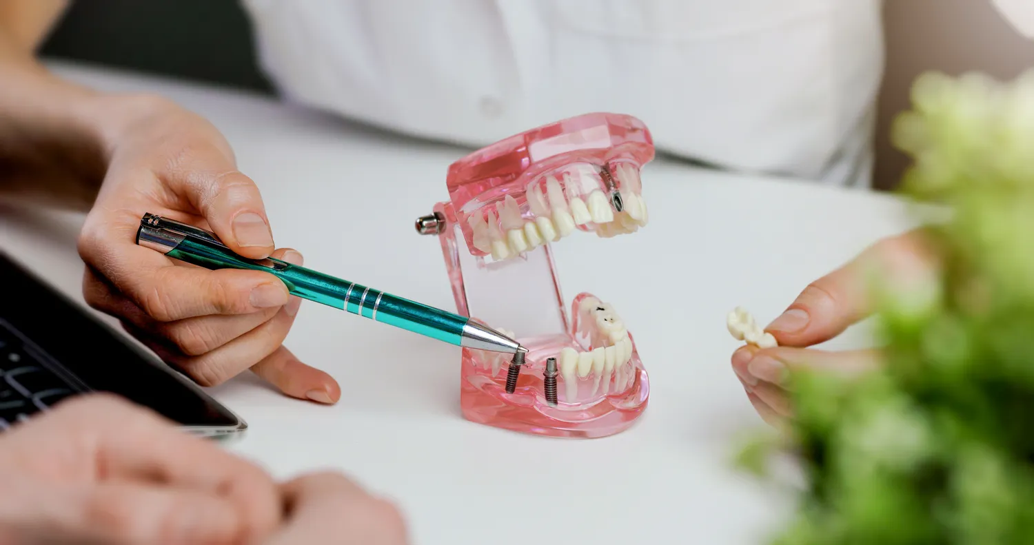 Implanty Warszawa gdzie najlepiej?