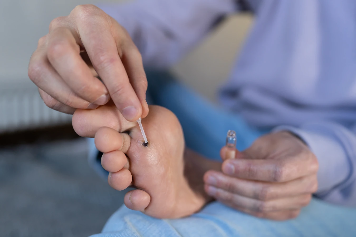 Czym jest pedicure leczniczy oraz na czym dokładnie polega?